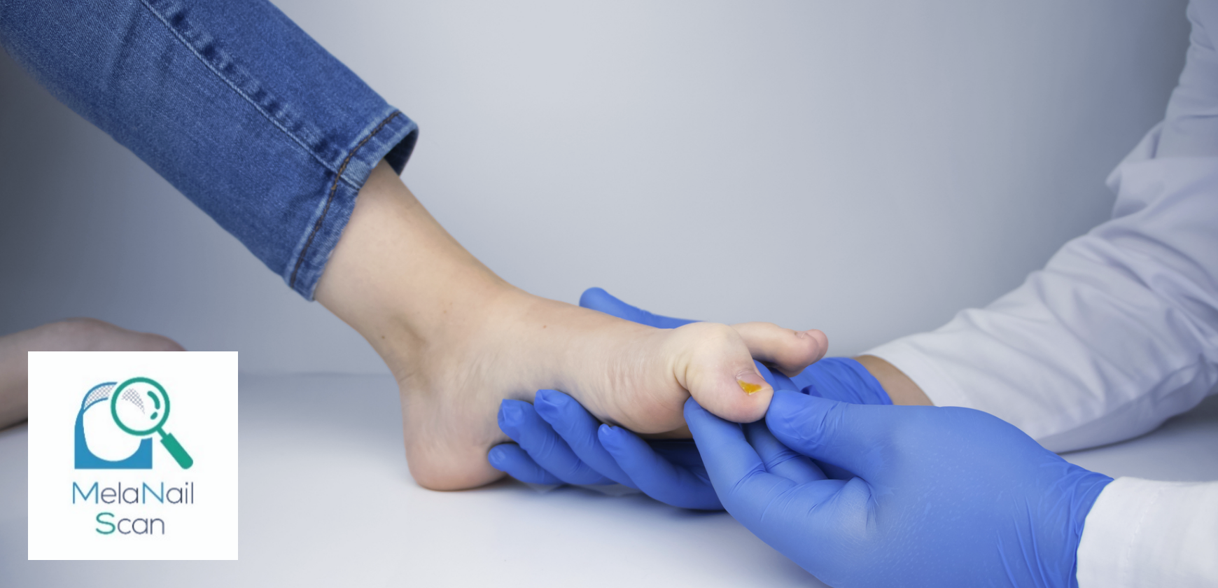 【Qs】MelaNailScan