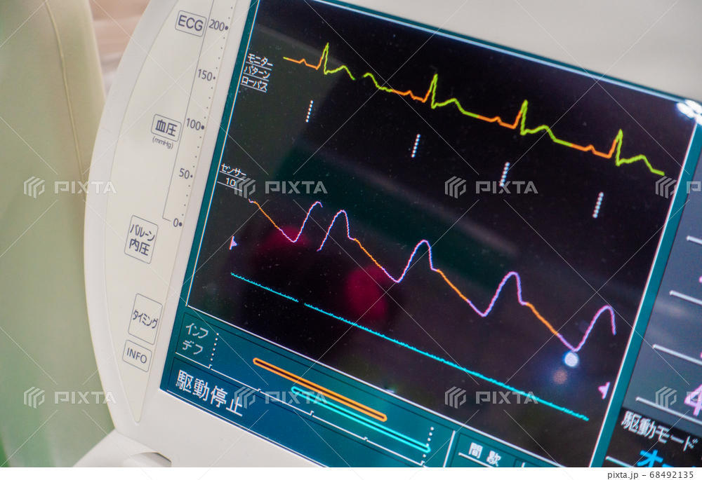 【Qs】心電図AI解析（Heart-Profile®）